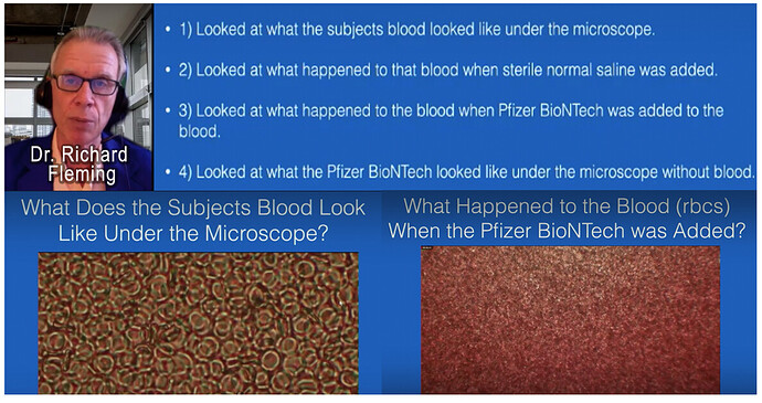 Dr. Richard Fleming Analysis of Blood after Jab