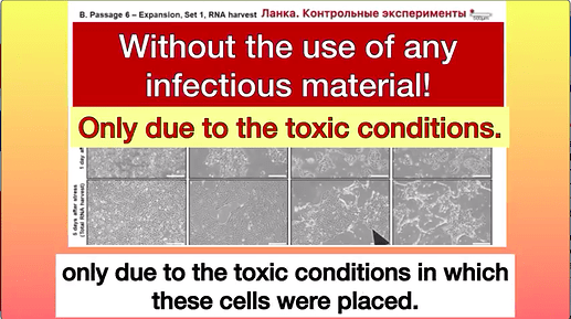 no infections material, just toxic conditions