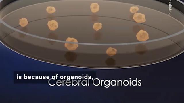 organoids